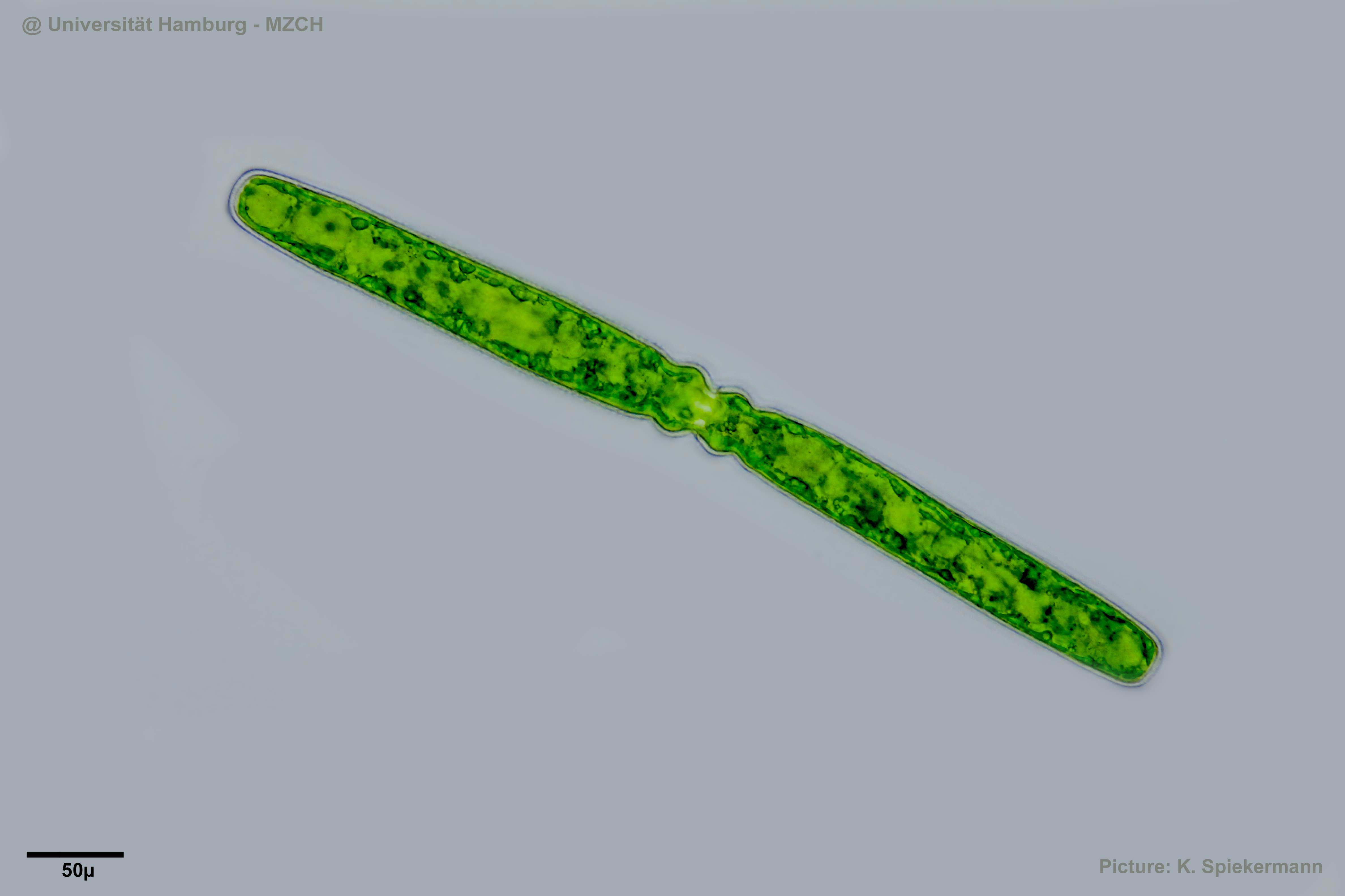 712_Pleurotaenium trabecula